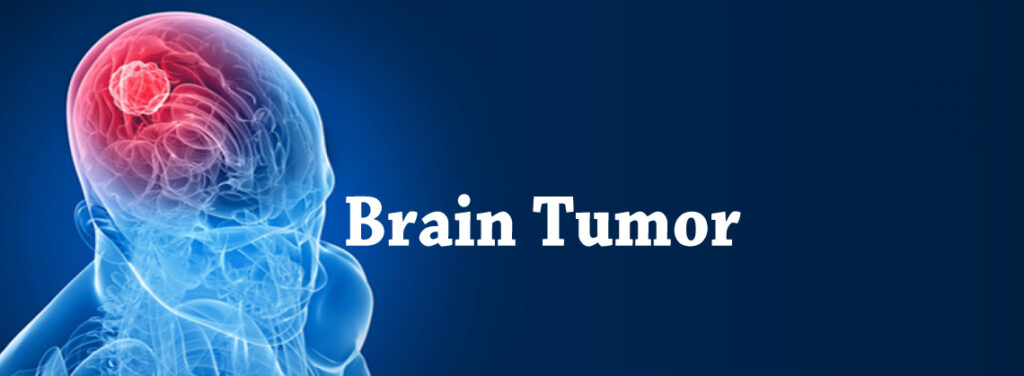 What are the Symptoms of Brain Tumor