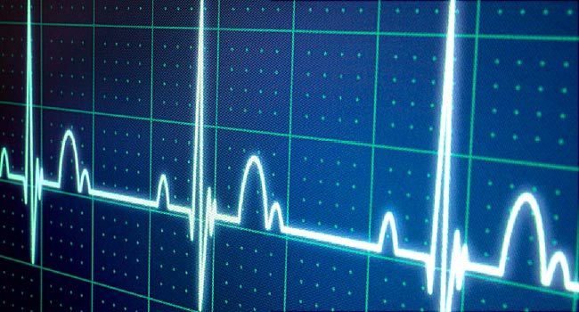 When should i be worried about an Irregular Heartbeat