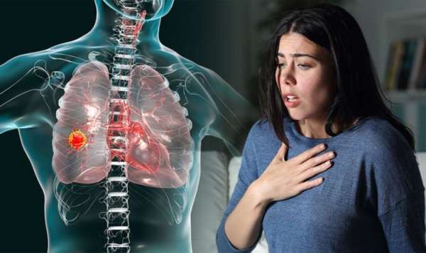 How does cough affect the condition of Lung Cancer?