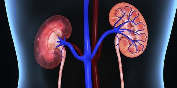 What is the average life expectancy after a Kidney Transplant