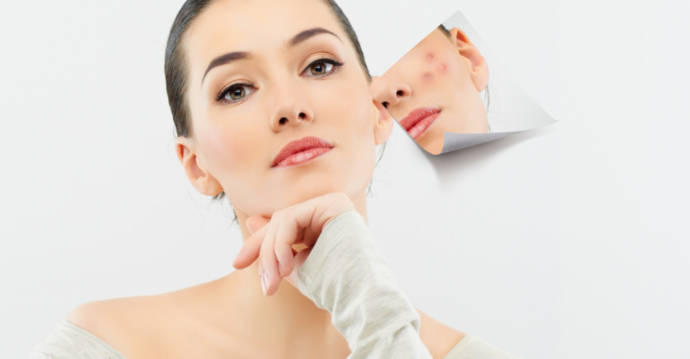 Which Is the Best Face Wash for Pimples and Marks in the UAE?