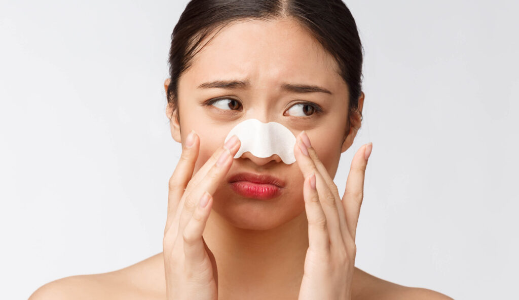 How to Get Rid of Blackheads on Nose
