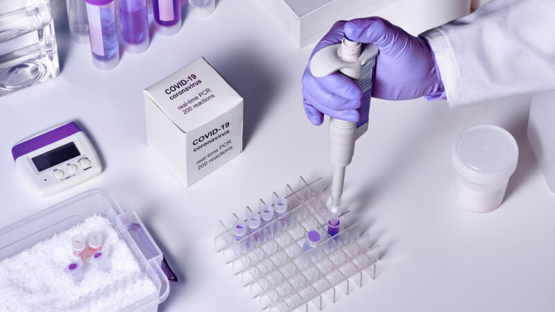 Top 10 Diagnostic Kits Manufacturers in India