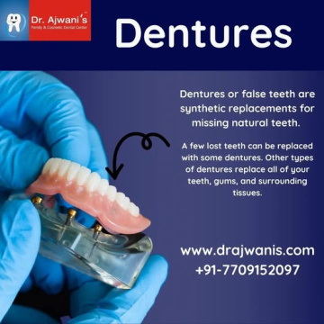 Trusted Clinic for Best Full Mouth Implant in Pune