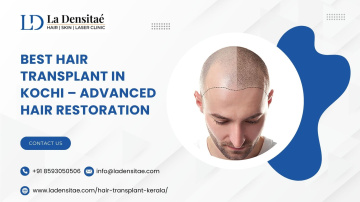 Best Hair Transplant in Kochi – Natural Hair Restoration