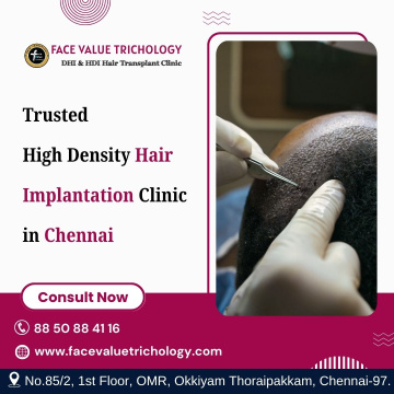 the Best Hair Implantation Suregeon Clinic in Chennai