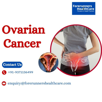 Best Ovarian Cancer Doctors in India