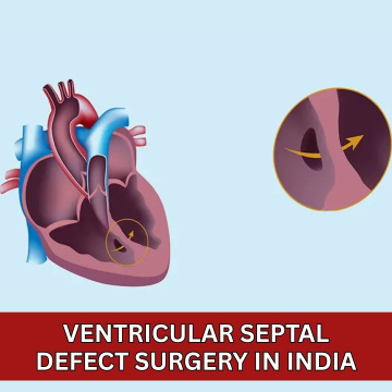 Ventricular Septal Defect Surgery in India