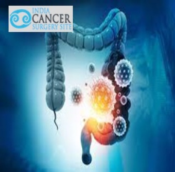 low Cost of Colon Cancer Treatment India