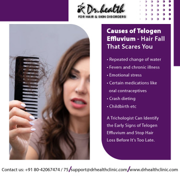 Best Hair Clinic in Bangalore | Hair Specialist in Bangalore | Dr. Health Clinic