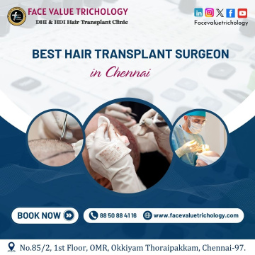 The Leading Direct hair Implantation Services in Chennai