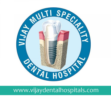 Dental implants | implant | vijay dental clinic | Dental services | Best Dental Clinic in Kondapur