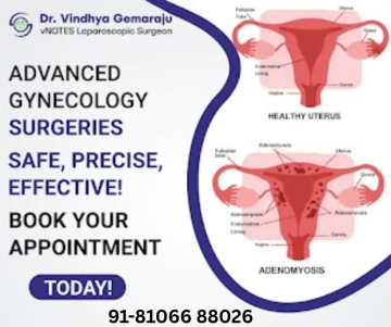 Best Gynecologist Hyderabad