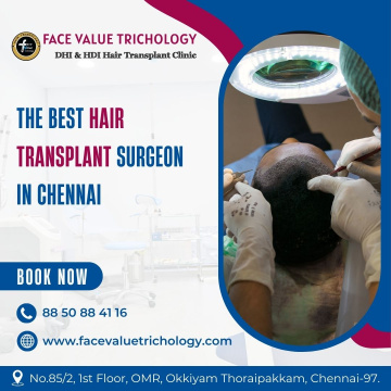 Best Hair Transplant Suregeon Clinic in Chennai