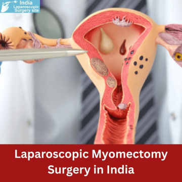 Robotic Myomectomy Surgery cost in India