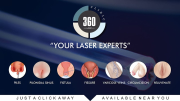 Laser 360 Clinic - Best Laser Treatment for Piles, Fistula and Fissure in Delhi