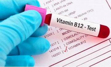 Vitamin b12 Deficiency | Vitamin B12 Test Price | Redcliffe Labs
