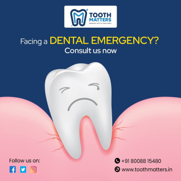 Expert Root Canal Treatment at Tooth Matters