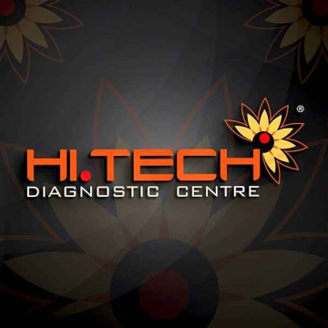Best Lab in Kochi | Home Blood Collection | Xray @ Home