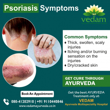 Best Ayurvedic Treatment for Psoriasis in Bangalore | Vedam