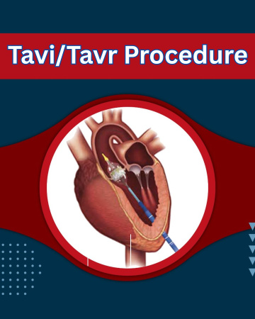 Top Hospitals for Tavi/Tavr Procedure India