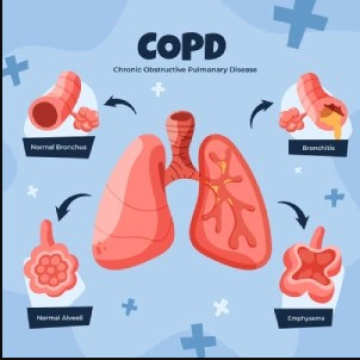Trusted COPD Specialist Doctor in Jaipur, Rajasthan – Dr. Sheetu Singh