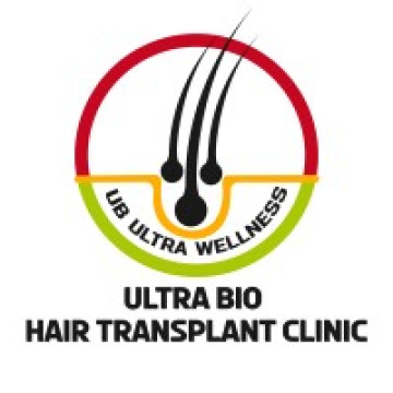 hair transplant  in Chennai.