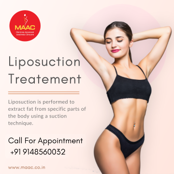 Best Liposuction Surgery in Bangalore | MAAC