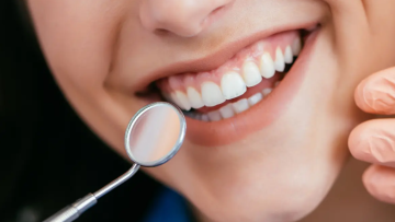 Smile Makeover Clinic in Ahmedabad | The Dental Wellness Centre
