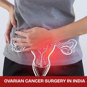 Low Cost Ovarian Cancer Surgery in India