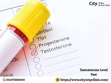 Testosterone Level Test Price Know Cost Before You Book