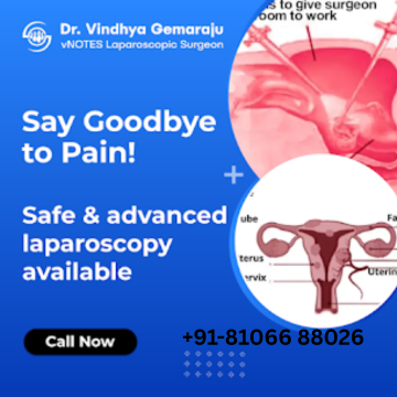 laparoscopic Gynecologist Hyderabad