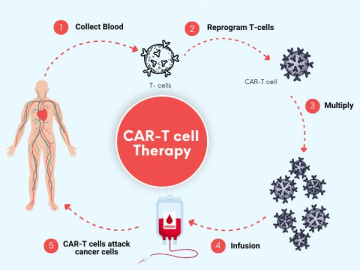 فهم العلاج المناعي باستخدام الخلايا التائية CAR T لعلاج سرطان الإنسان، جيبوتي