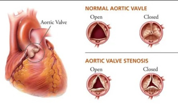 Renowned Heart Doctor in India – Dr. Ravinder Singh Rao