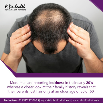 Best Dandruff Treatment in Bangalore | Dandruff Specialist | Dr. Health Clinic