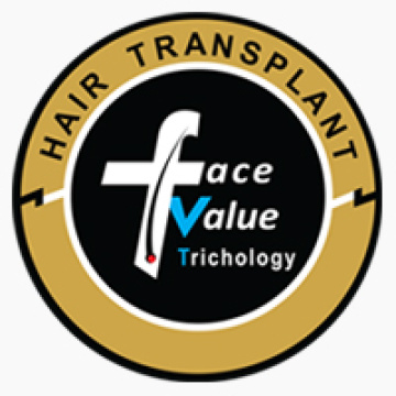 Direct Hair Transplant Service in Chennai