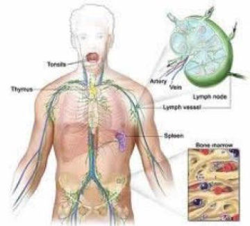 Low Cost Lymphoma treatment in India