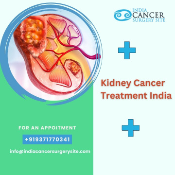 Kidney Cancer Operation in India