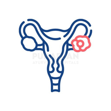 Best Ovarian Cancer Treatment Hospitals in Bangalore