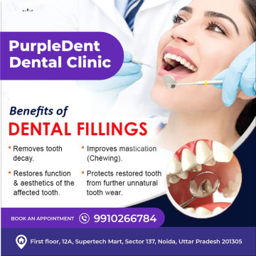 Dentist Consultation in Noida