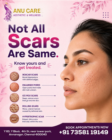 Anu care Aesthetic & Wellness | skin & hair clinic in anna nagar