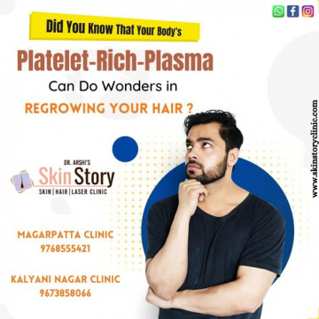 Hair Loss Treatment in Magarpatta Pune | Hair Specialist in  Kalyani Nagar Pune | Skin Story